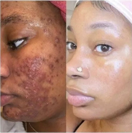 SKIN WHITENING FACE CREAM