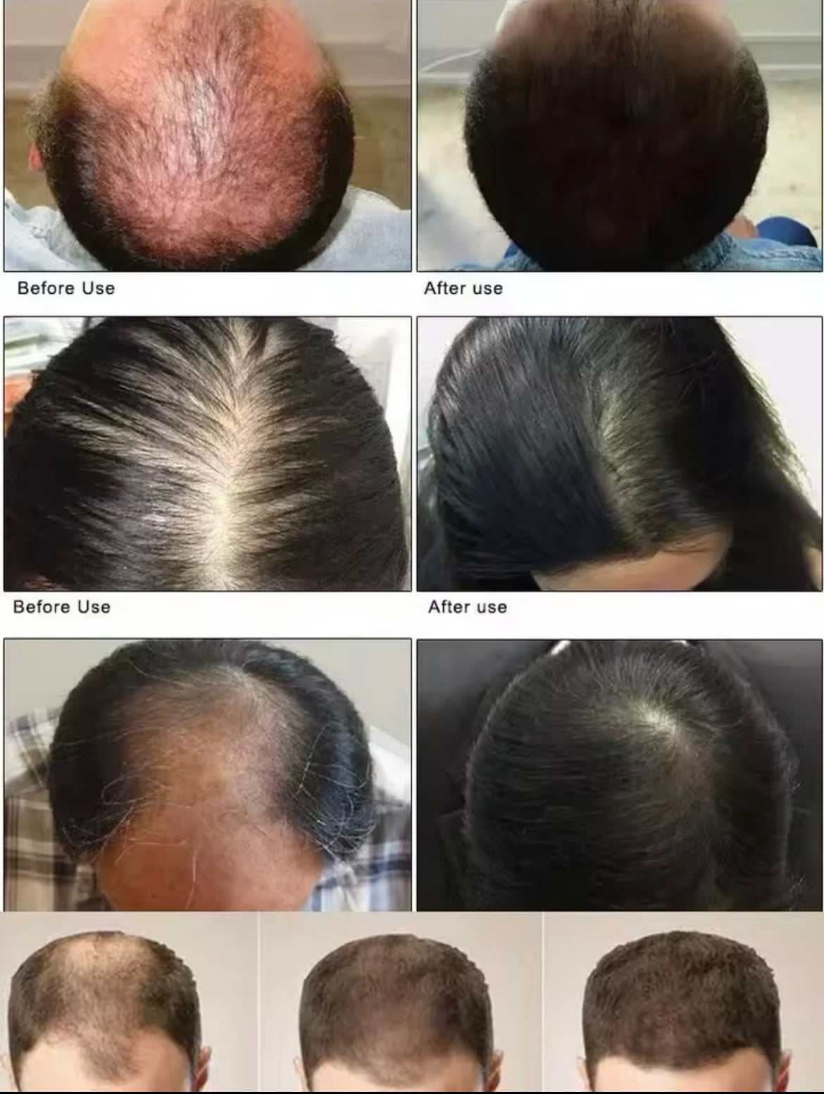 SERUM INDIAN HAIR GROWTH OIL GALLON